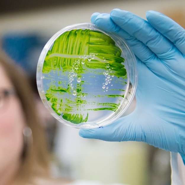 image of student with petri dish