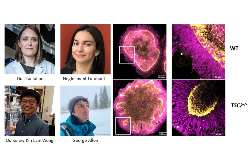 MBB and INN researchers engineer self-folding human brain tissues that recreate the earliest stages of brain development