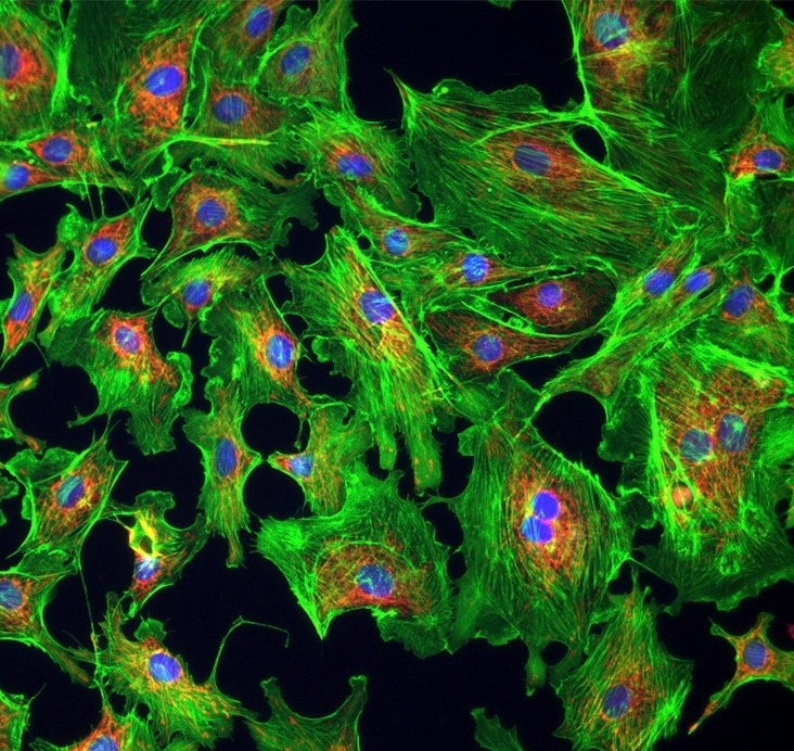 Cell biology, development & disease - microscope image of cells, dyed green and orange